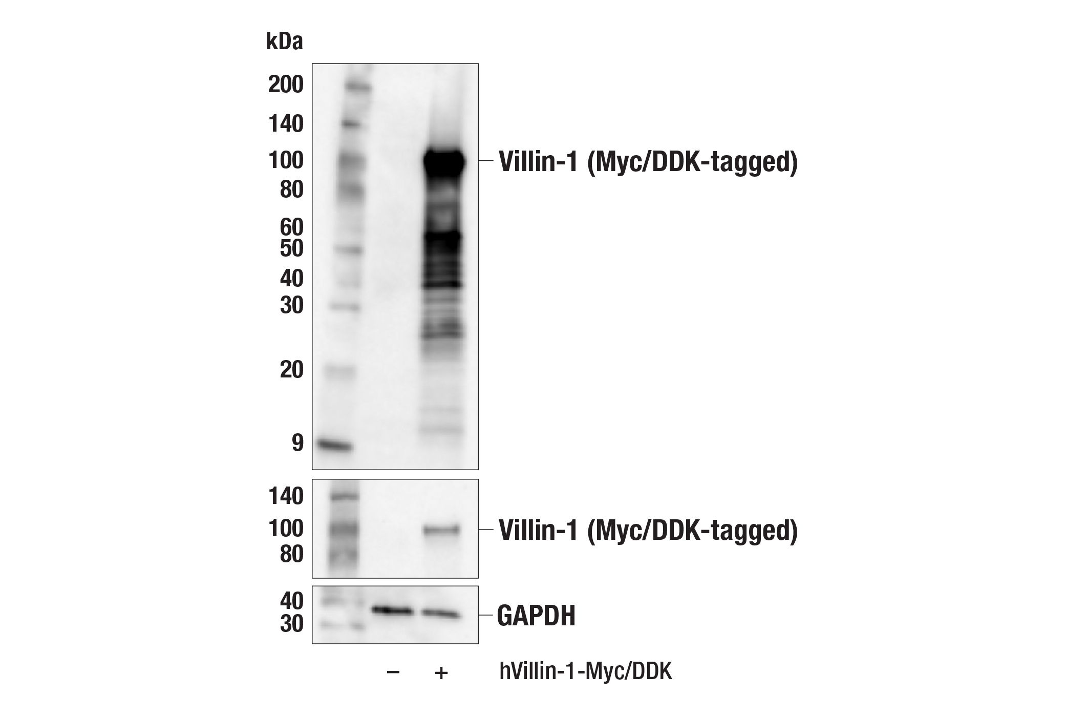 Western Blotting Image 2: Villin-1 (F5F3V) Rabbit mAb