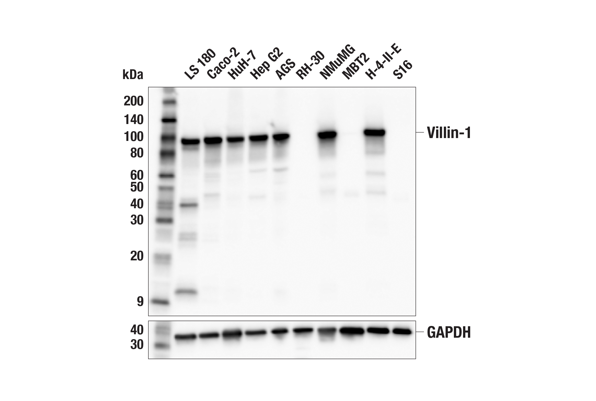 Western Blotting Image 1: Villin-1 (F5F3V) Rabbit mAb