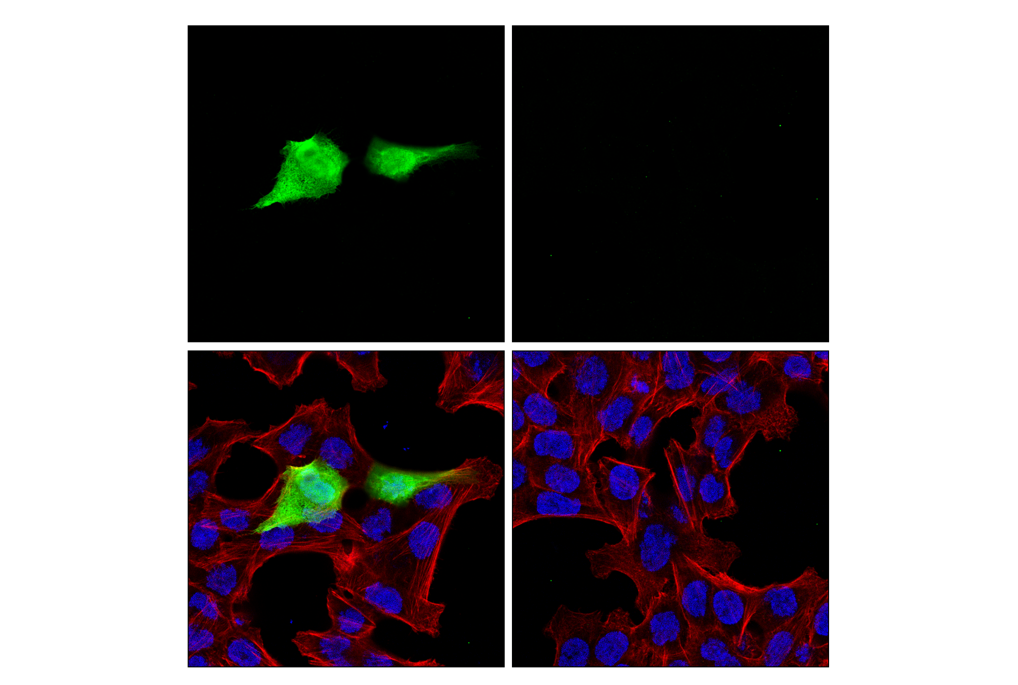 Immunofluorescence Image 1: V5-Tag (E9H8O) Mouse mAb (BSA and Azide Free)