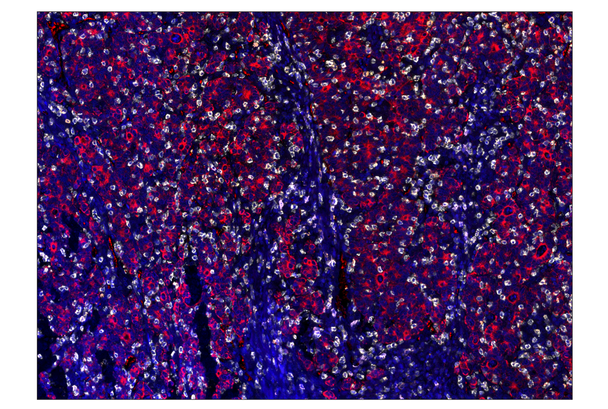 Immunohistochemistry Image 7: CD20 (E7B7T) & CO-0011-594 SignalStar™ Oligo-Antibody Pair