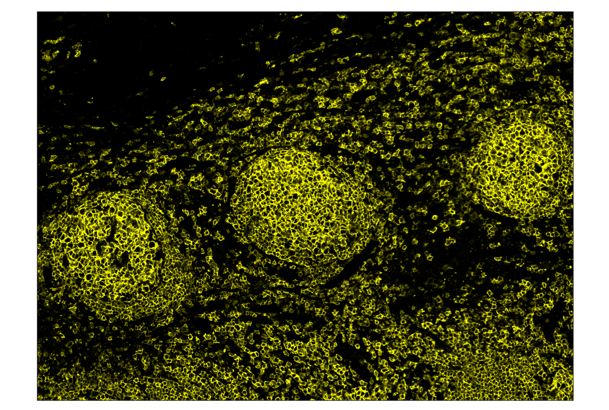 Immunohistochemistry Image 3: CD20 (E7B7T) & CO-0011-488 SignalStar™ Oligo-Antibody Pair