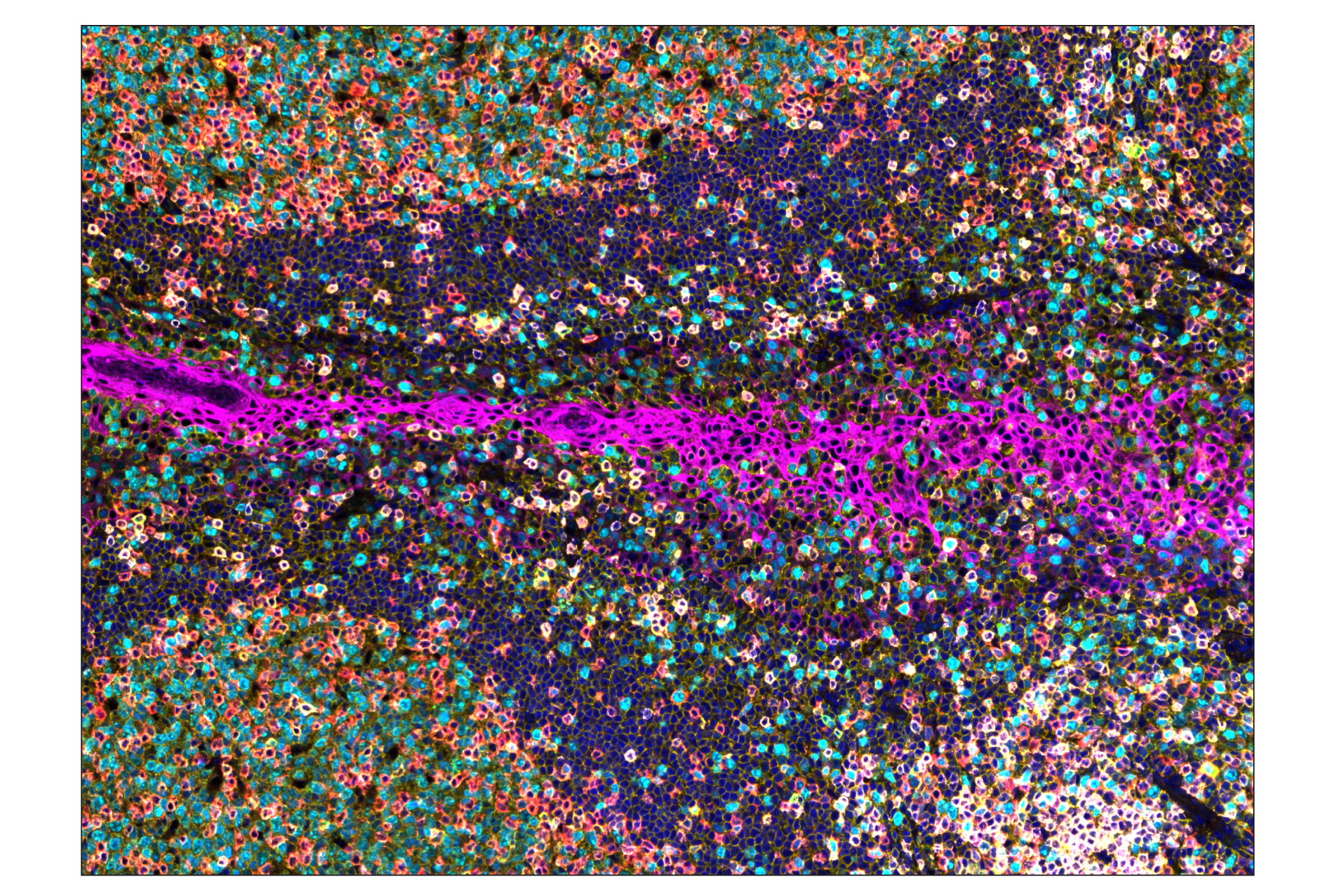 Immunohistochemistry Image 1: CD20 (E7B7T) & CO-0011-647 SignalStar™ Oligo-Antibody Pair