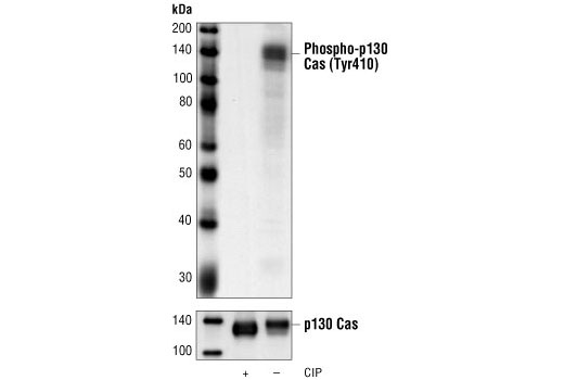 Western Blotting Image 1: Phospho-p130 Cas (Tyr410) Antibody