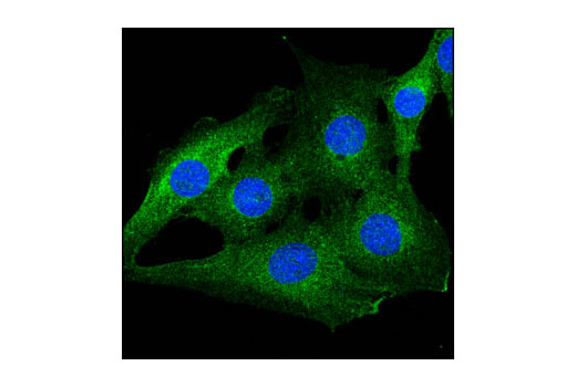 Immunofluorescence Image 1: NEDD4L Antibody