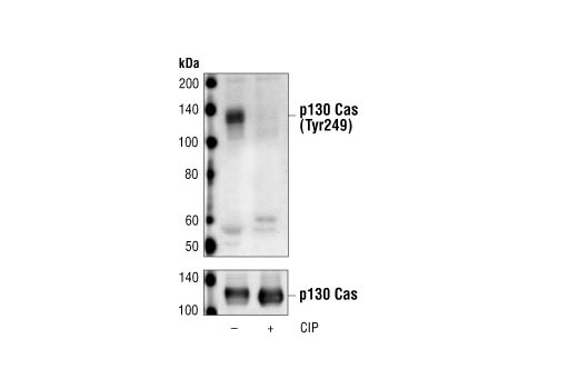 Western Blotting Image 1: Phospho-p130 Cas (Tyr249) Antibody