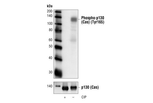 Western Blotting Image 1: Phospho-p130 Cas (Tyr165) Antibody