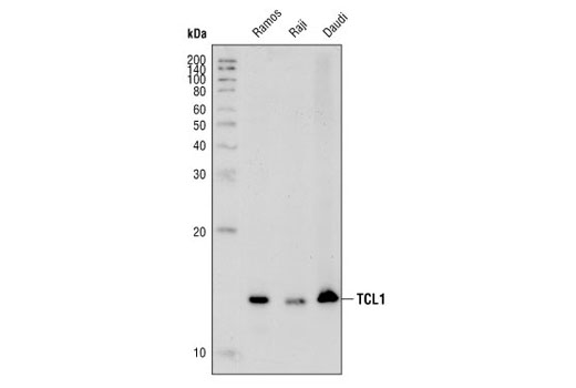 Western Blotting Image 1: TCL1 (1-21) Mouse mAb