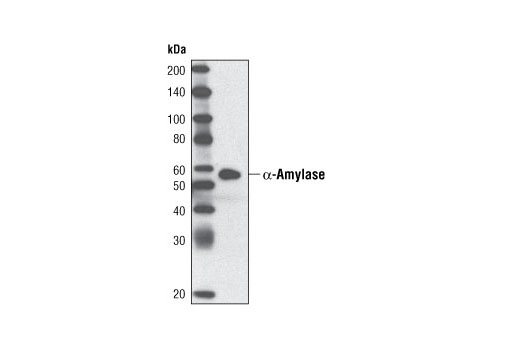 Western Blotting Image 1: α-Amylase Antibody