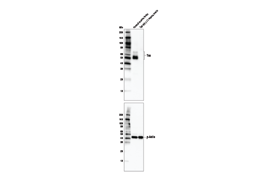 Image 5: Tau Mouse Model Neuronal Viability IF Antibody Sampler Kit