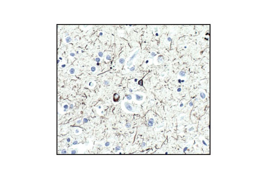  Image 19: Alzheimer's Disease Antibody Sampler Kit
