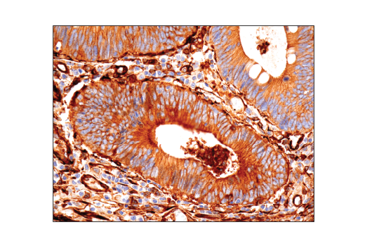 Immunohistochemistry Image 2: Vinculin (E1E9V) XP® Rabbit mAb (BSA and Azide Free)