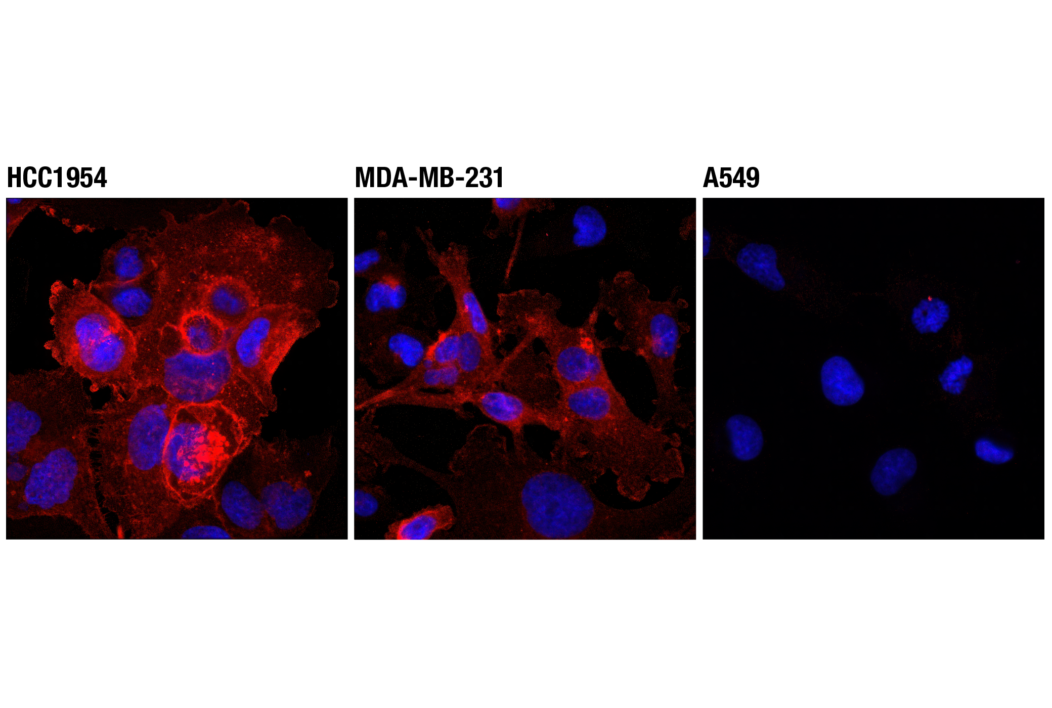 Immunofluorescence Image 1: PD-L1 (Extracellular Domain Specific) (D8T4X) Rabbit mAb (Alexa Fluor® 555 Conjugate)