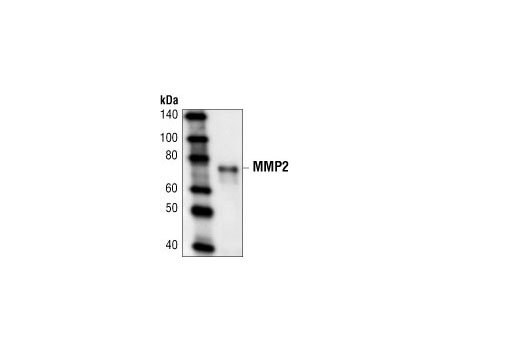 Western Blotting Image 1: MMP-2 Antibody