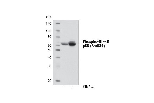 Western Blotting Image 1: Phospho-NF-κB p65 (Ser536) (93H1) Rabbit mAb (Biotinylated)