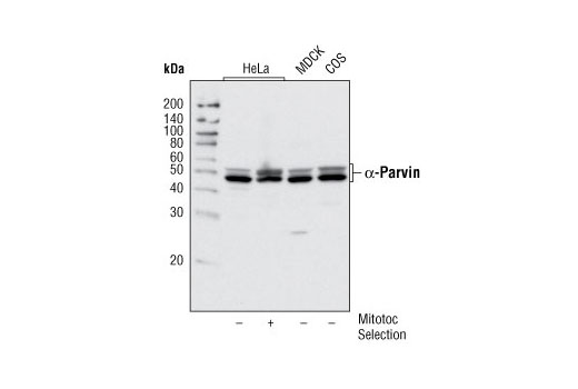 Western Blotting Image 1: α-Parvin Antibody