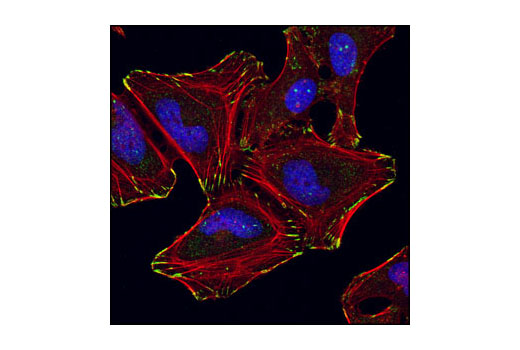 Immunofluorescence Image 1: α-Parvin Antibody