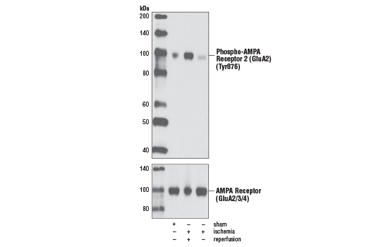 Western Blotting Image 1: Phospho-AMPA Receptor 2 (GluA2) (Tyr876) Antibody