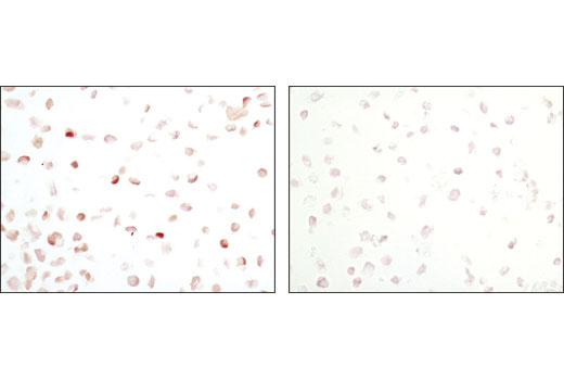 Immunohistochemistry Image 2: Phospho-Stat5 (Tyr694) (C71E5) Rabbit mAb (BSA and Azide Free)