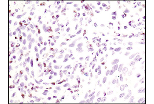 Immunohistochemistry Image 3: Phospho-Stat5 (Tyr694) (C71E5) Rabbit mAb (BSA and Azide Free)