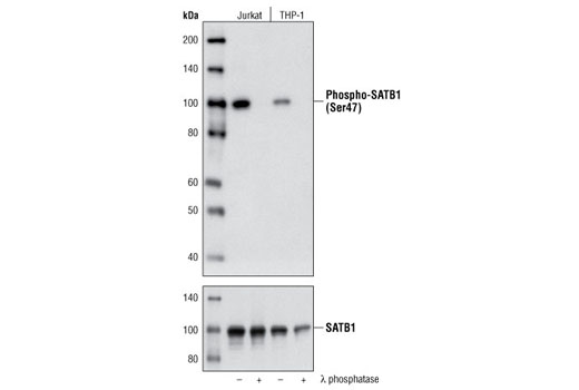 Western Blotting Image 1: Phospho-SATB1 (Ser47) Antibody