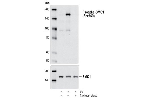 Western Blotting Image 1: Phospho-SMC1 (Ser360) Antibody