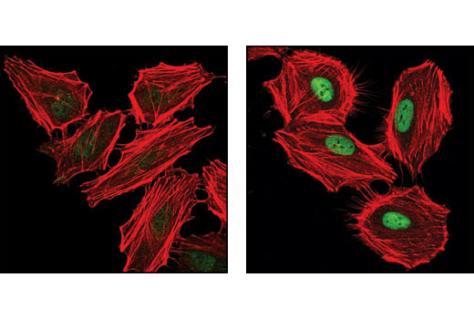 Immunofluorescence Image 1: Phospho-SMC1 (Ser360) Antibody