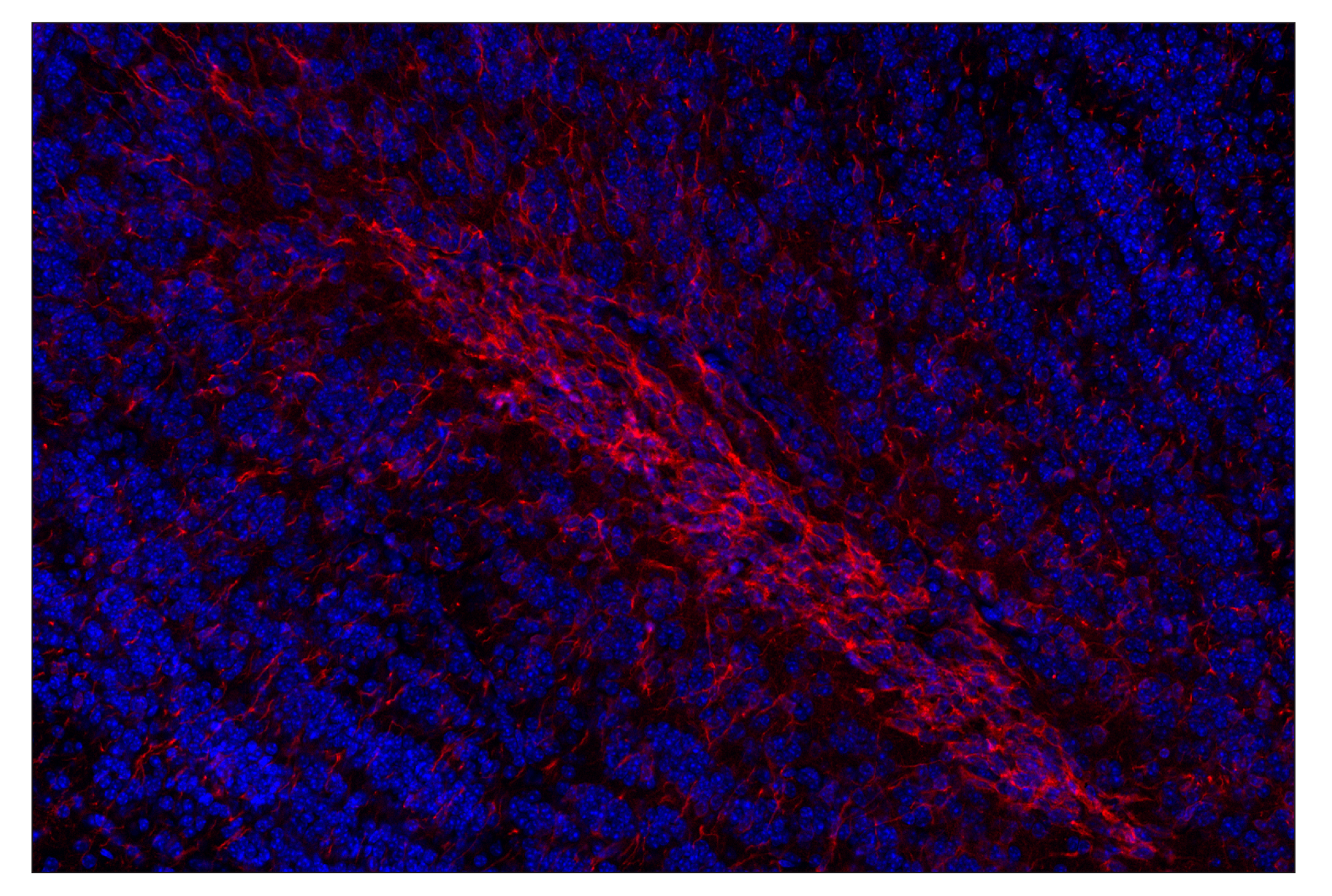 Immunohistochemistry Image 2: Doublecortin (E3S7L) Rabbit mAb (Alexa Fluor® 555 Conjugate)