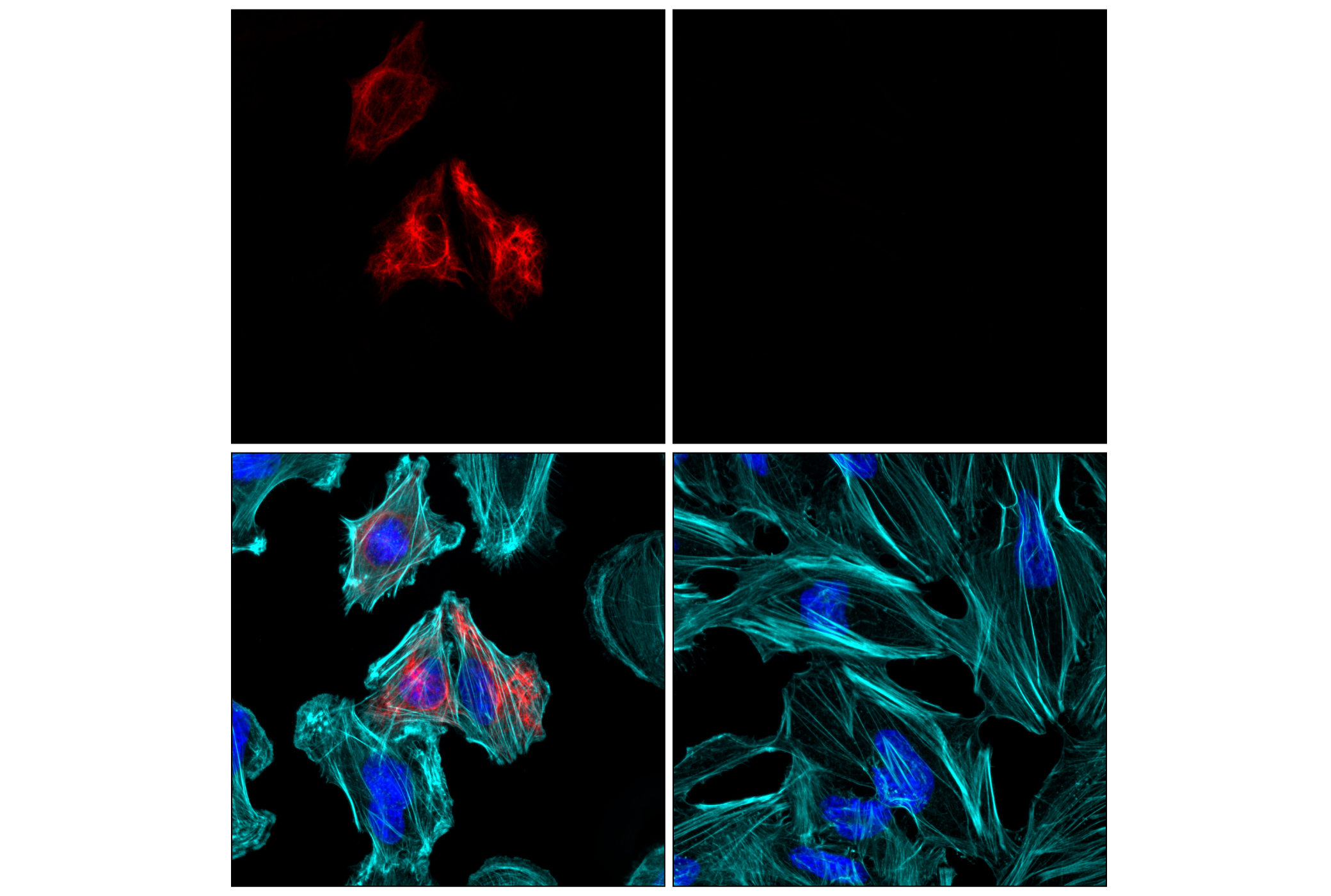 Immunofluorescence Image 2: GFAP (E4L7M) XP® Rabbit mAb (Alexa Fluor® 555 Conjugate)