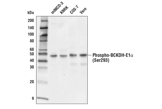 Western Blotting Image 1: Phospho-BCKDH-E1α (Ser293) (E2V6B) Rabbit mAb