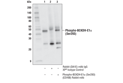 Immunoprecipitation Image 1: Phospho-BCKDH-E1α (Ser293) (E2V6B) Rabbit mAb