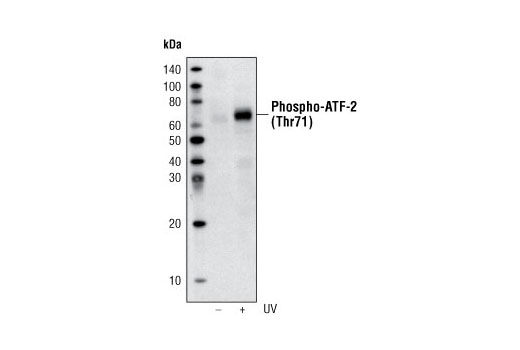 Western Blotting Image 1: Phospho-ATF-2 (Thr71) (11G2) Rabbit mAb (Biotinylated)