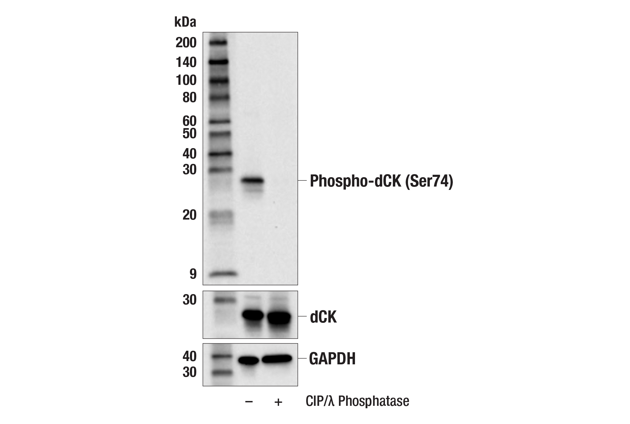 Western Blotting Image 1: Phospho-dCK (Ser74) Antibody