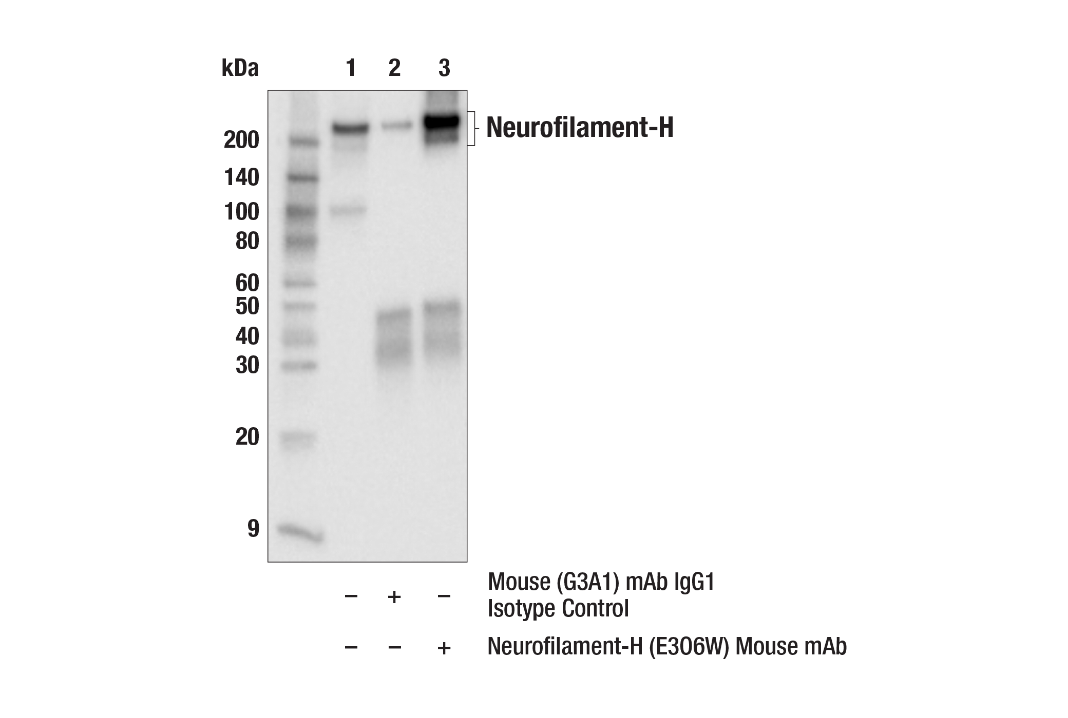 Immunoprecipitation Image 1: Neurofilament-H (E3O6W) Mouse mAb