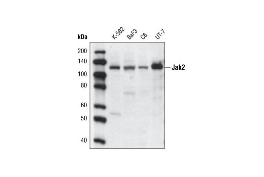Western Blotting Image 1: Jak2 (D2E12) XP® Rabbit mAb (Biotinylated)