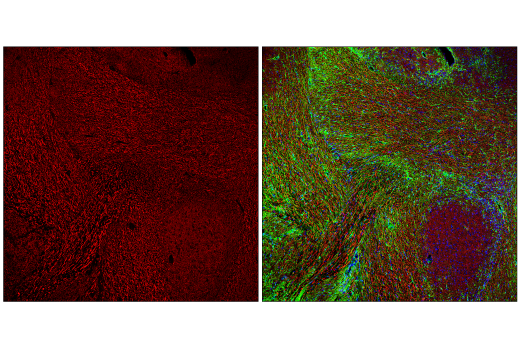 Immunofluorescence Image 2: Neurofilament-H (E7Z7G) Rabbit mAb (BSA and Azide Free)