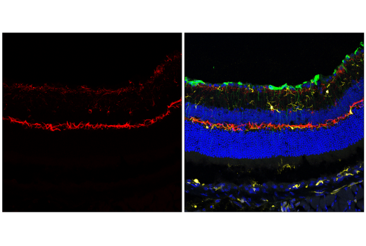 Immunofluorescence Image 3: Neurofilament-H (E7Z7G) Rabbit mAb (BSA and Azide Free)