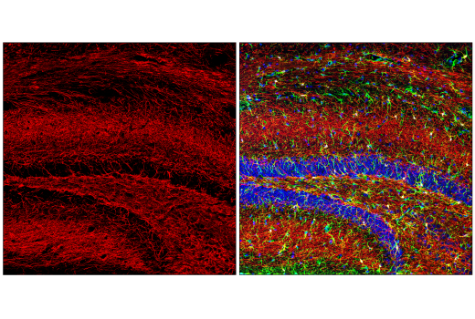 Immunofluorescence Image 1: Neurofilament-H (E7Z7G) Rabbit mAb (BSA and Azide Free)