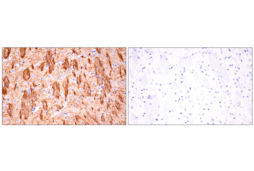 Immunohistochemistry Image 8: Neurofilament-H (E7Z7G) Rabbit mAb (BSA and Azide Free)