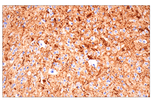 Immunohistochemistry Image 1: Neurofilament-H (E7Z7G) Rabbit mAb (BSA and Azide Free)