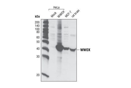 Western Blotting Image 1: WWOX Antibody