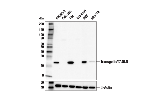 Western Blotting Image 1: Transgelin/TAGLN Antibody