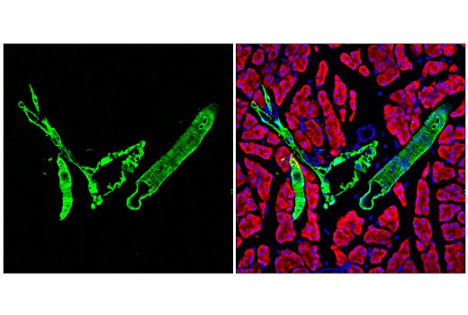 Immunofluorescence Image 3: Transgelin/TAGLN Antibody
