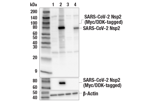 Western Blotting Image 1: SARS-CoV-2 Nsp2 Antibody
