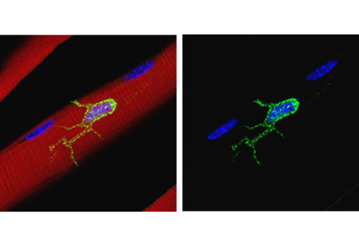 Immunofluorescence Image 1: M-Cadherin (D4B9L) Rabbit mAb