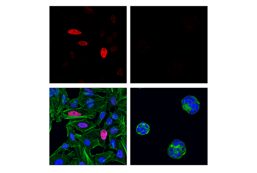 Immunofluorescence Image 1: c-Jun (60A8) Rabbit mAb (Alexa Fluor® 647 Conjugate)