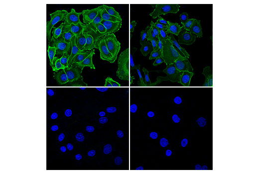 Immunofluorescence Image 1: Glut3 (E7M7V) Rabbit mAb