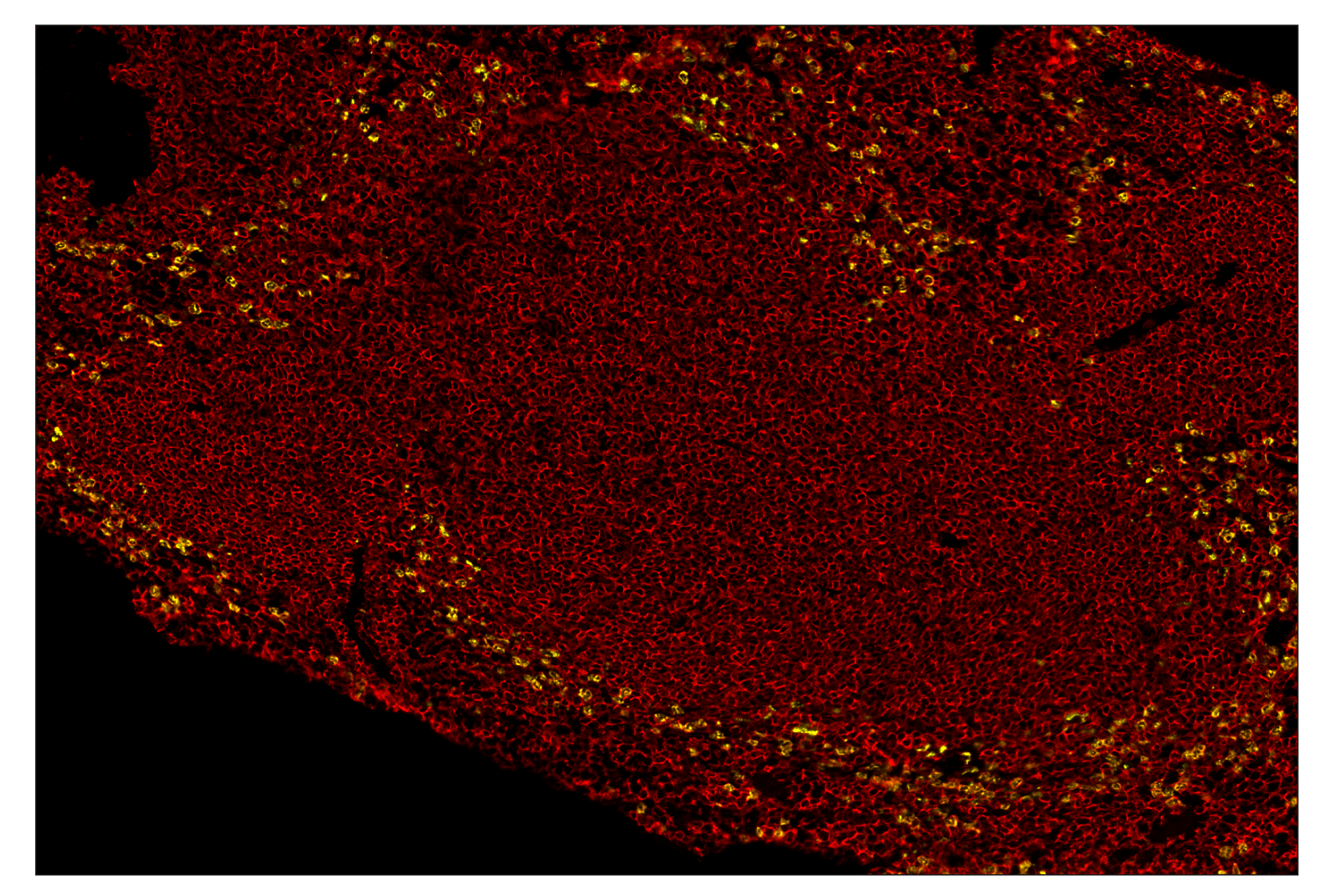 Immunohistochemistry Image 8: CD45 (D3F8Q) & CO-0046-594 SignalStar™ Oligo-Antibody Pair