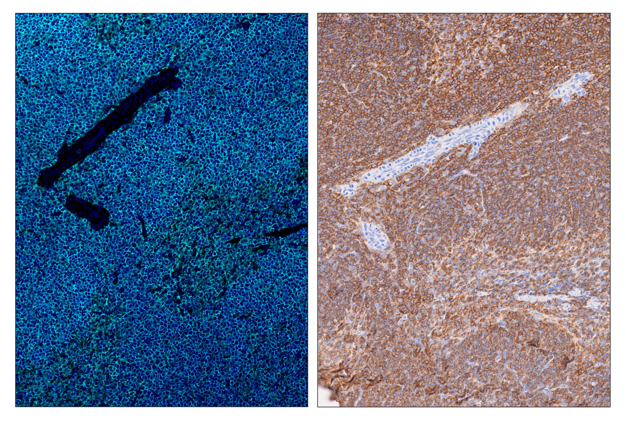 Immunohistochemistry Image 6: CD45 (D3F8Q) & CO-0046-594 SignalStar™ Oligo-Antibody Pair