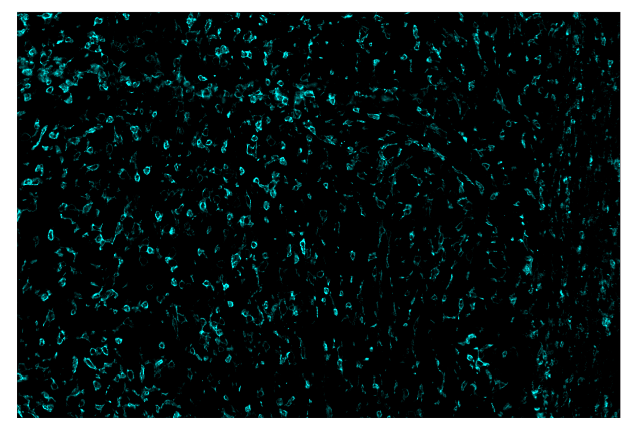 Immunohistochemistry Image 5: CD45 (D3F8Q) & CO-0046-594 SignalStar™ Oligo-Antibody Pair