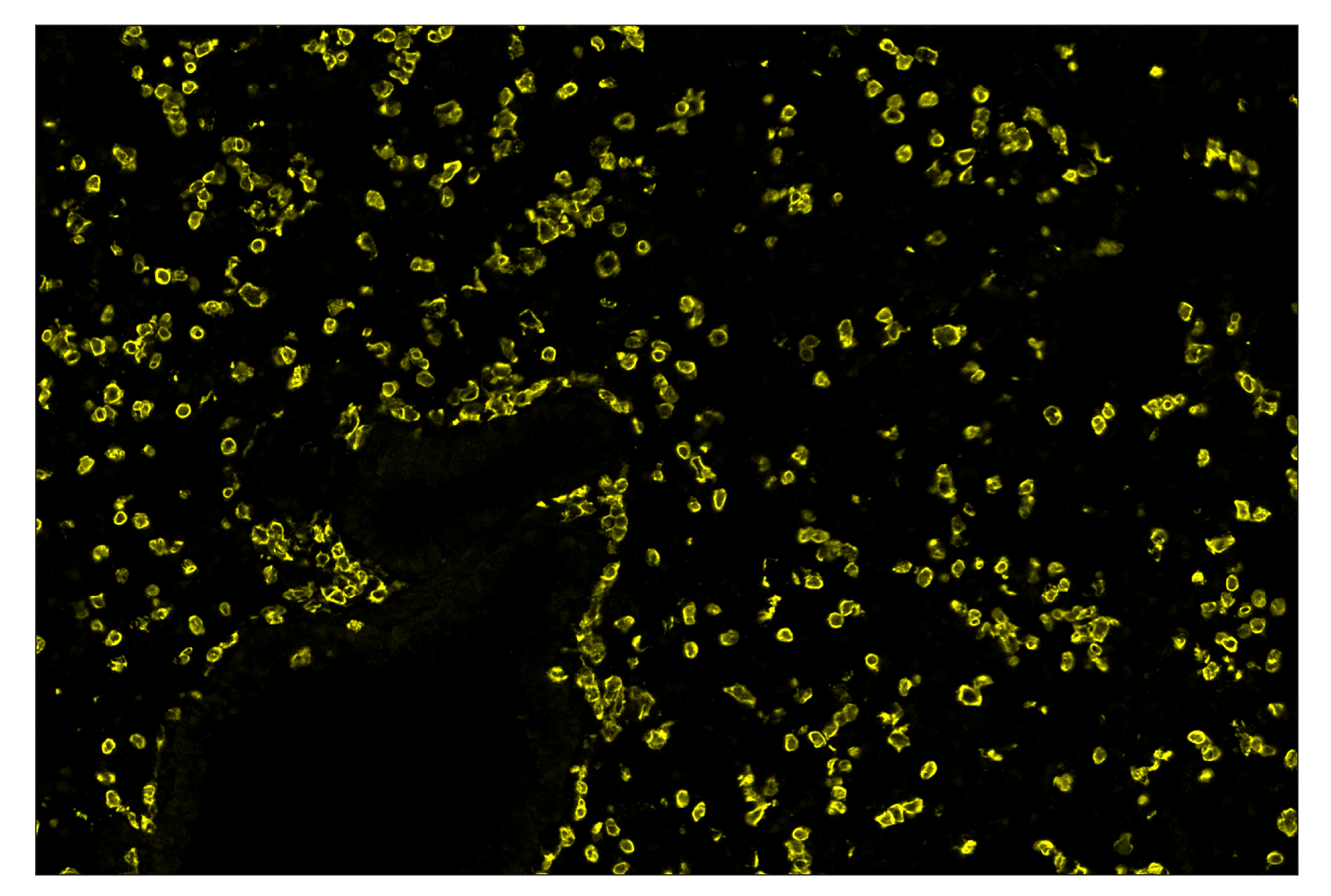 Immunohistochemistry Image 3: CD45 (D3F8Q) & CO-0046-750 SignalStar™ Oligo-Antibody Pair
